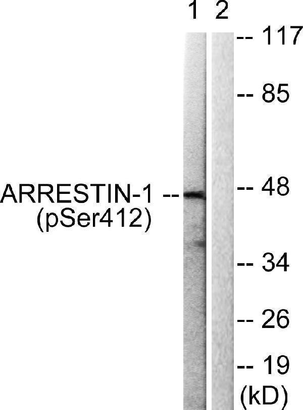 a02185s412 arrb1 primary antibodies wb testing 2
