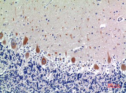 a02187 kir3dl1 primary antibodies ihc testing 1