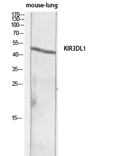 a02187 kir3dl1 primary antibodies wb testing 2