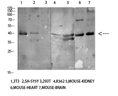 a02187 kir3dl1 primary antibodies wb testing 3
