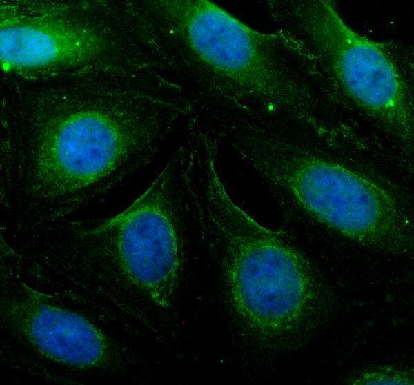 IF analysis of PSMB8 using anti-PSMB8 antibody (A02188-3)