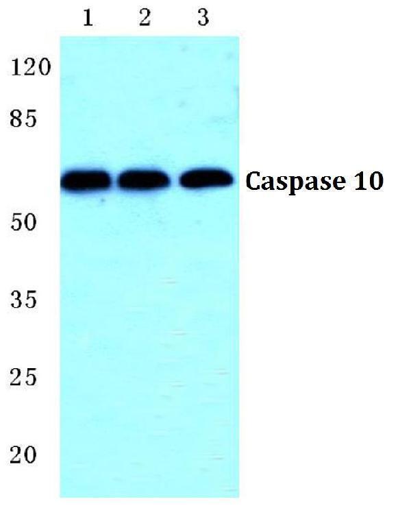 Western blot (WB) analysis of Caspase 10 polyclonal antibody at 1:500 dilution
Lane1:HEK293T cell lysate
Lane2:NIH-3T3 cell lysate
Lane3:H9C2 cell lysate