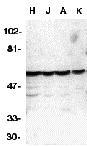 Western blot analysis of caspase-10 in HeLa (H), Jurkat (J), A431 (A), K562 (K) whole cell lysates with Caspase-10 antibody at 1 μg/mL