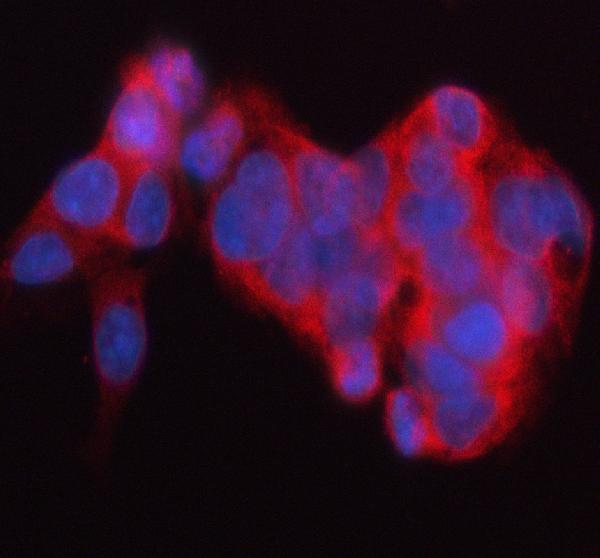 a02191 1 frizzled 4 primary antibodies if testing 1