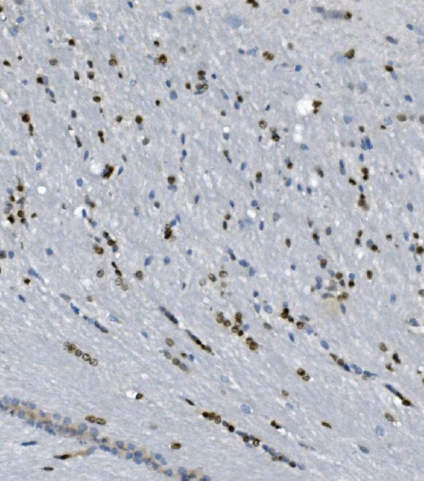 a02197 1 tkt primary antibodies ihc testing 5