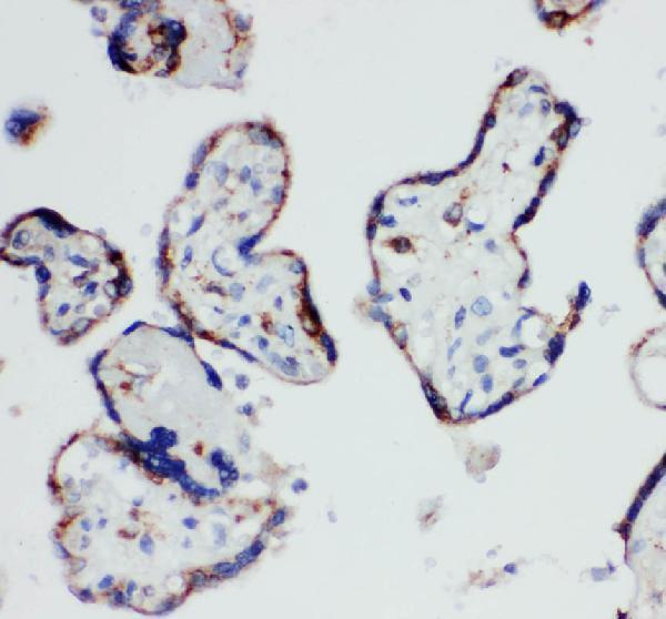  IHC analysis of HSD17B1 using anti-HSD17B1 antibody (A02198)