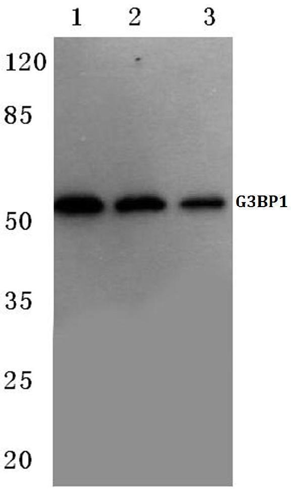 Western blot (WB) analysis of G3BP-1 (D226) polyclonal antibody at 1:500 dilution
Lane1:A549 cell lysate
Lane2:Mouse heart tissue lysate
Lane3:Rat heart tissue lysate