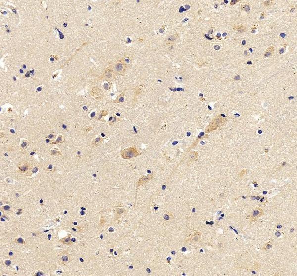 IHC analysis of G3BP1 using anti-G3BP1 antibody (A02199-2)