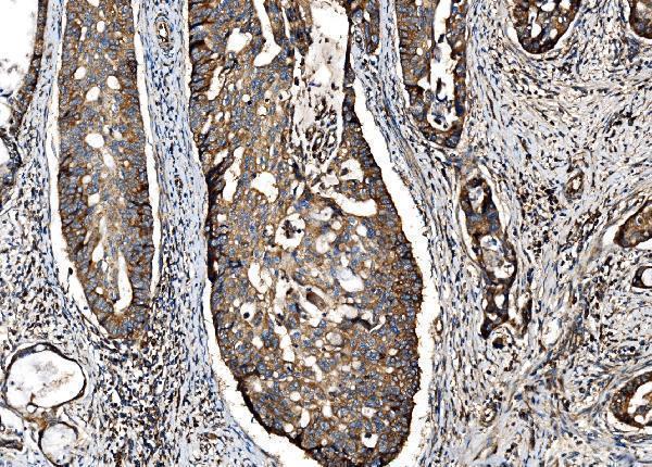  IHC analysis of G3BP/G3BP1 using anti-G3BP/G3BP1 antibody (A02199-2)