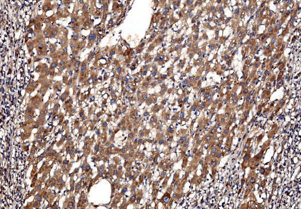 a02199 2 g3bp1 primary antibodies ihc testing 4