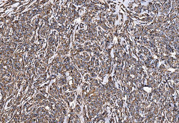 a02199 2 g3bp1 primary antibodies ihc testing 5