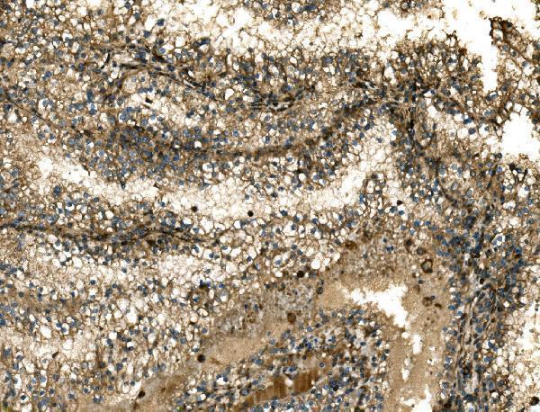 a02199 2 g3bp1 primary antibodies ihc testing 6
