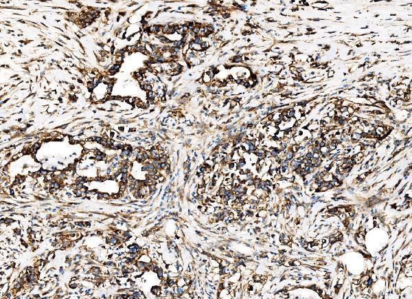 a02199 2 g3bp1 primary antibodies ihc testing 7