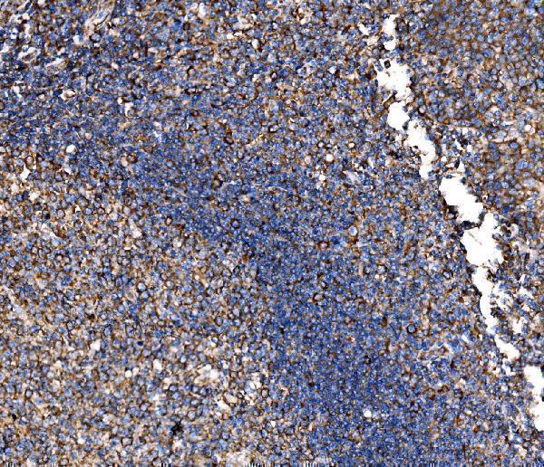 a02199 2 g3bp1 primary antibodies ihc testing 8