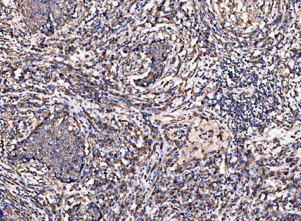 a02199 2 g3bp1 primary antibodies ihc testing 9