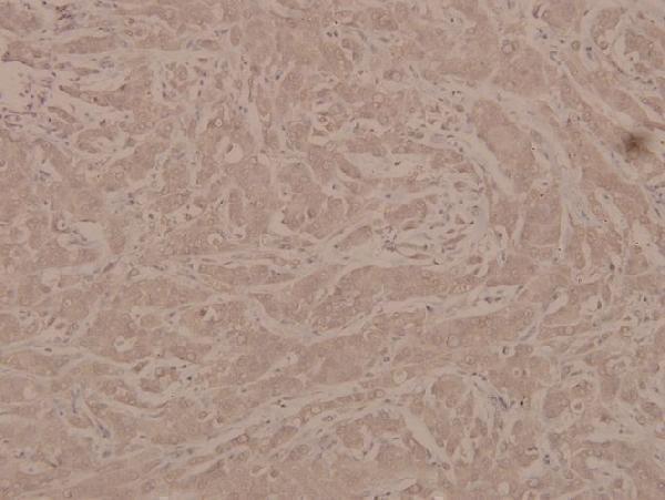 a02199s232 g3bp1 primary antiboties ihc testing 2