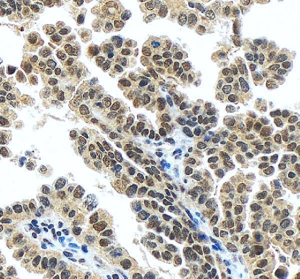IHC analysis of DR1 using anti-DR1 antibody (A02204-1)