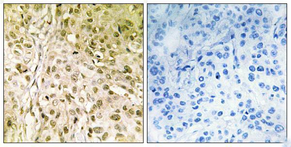 a02205 polq primary antibodies ihc testing 1