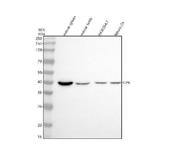  Western blot analysis of GP6 using anti-GP6 antibody (A02208-1)