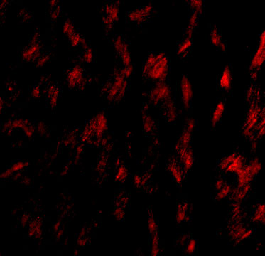 Immunofluorescence of GPVI in Human Heart tissue with GPVI antibody at 20 μg/mL