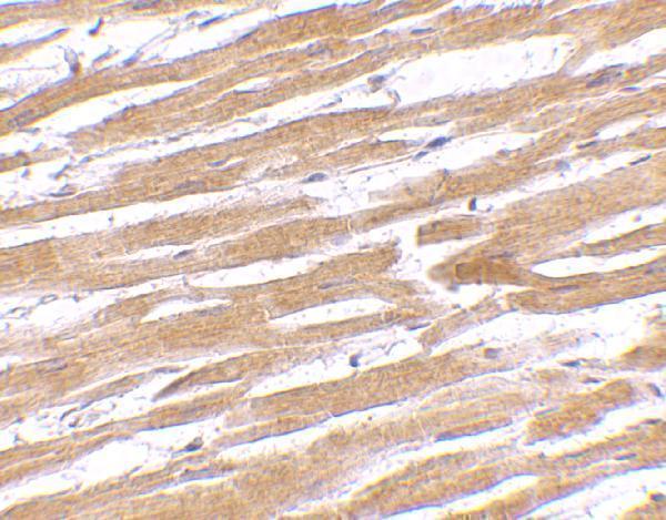 Immunohistochemistry of GPVI in human heart tissue with GPVI antibody at 10 μg/mL