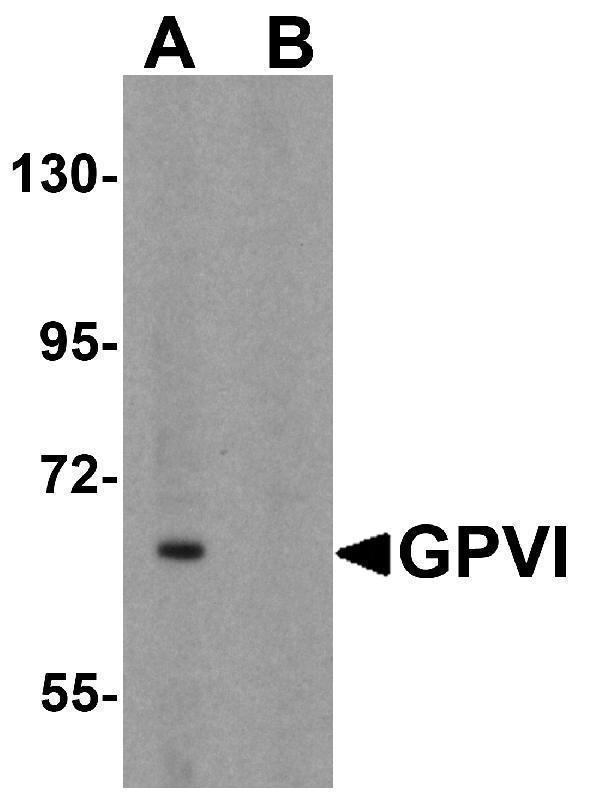 Western blot analysis of GPVI in K562 cell lysate with GPVI antibody at 1 μg/mL in (A) the absence and (B) the presence of blocking peptide