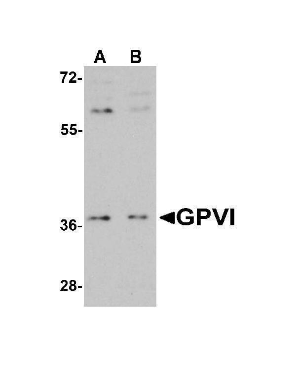 a02208 gp6 primary antibodies wb testing 4