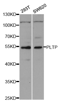 a02209 pltp primary antiboties wb testing 1