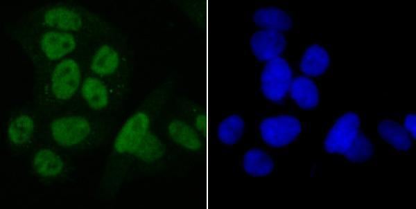 ICC staining SET in Hela cells (green)