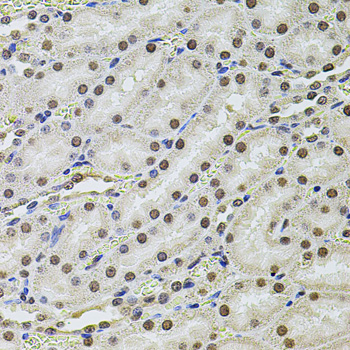 Immunohistochemistry of paraffin-embedded rat kidney using SET/TAF1 antibody  at dilution of 1:100 