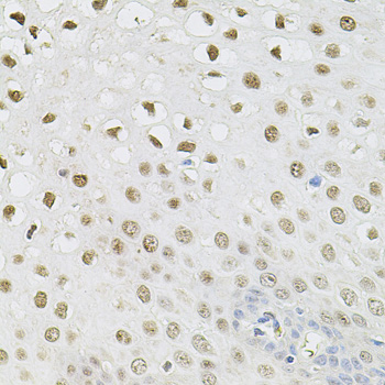 Immunohistochemistry of paraffin-embedded human esophagus using SET/TAF1 antibody  at dilution of 1:100 