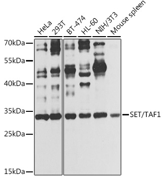 Western blot analysis of extracts of various cell lines, using SET/TAF1 antibody  at 1:1000 dilution