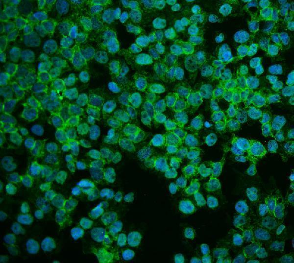  IF analysis of ASS1 using anti-ASS1 antibody (A02212-1)