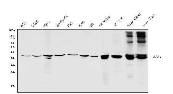  Western blot analysis of ASS1 using anti-ASS1 antibody (A02212-1)