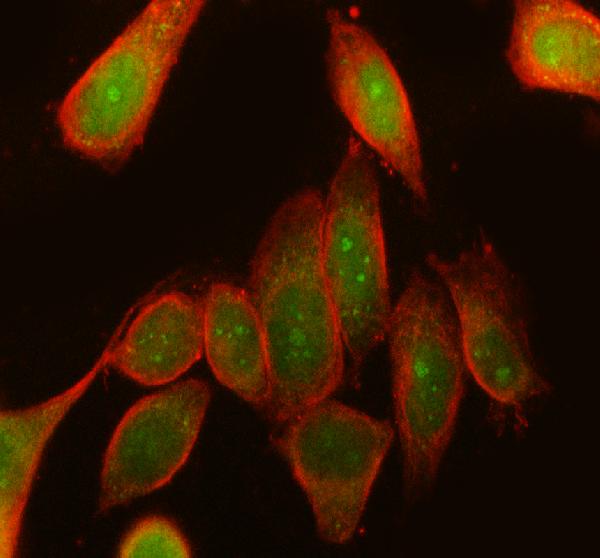 Figure 2. IF analysis of RPS6KA3 using anti-RPS6KA3 antibody (A02215-2) and anti-Beta Tubulin antibody (M01857-3). RPS6KA3 was detected in immunocytochemical section of SiHa cell. Enzyme antigen retrieval was performed using IHC enzyme antigen retrieval reagent (AR0022) for 15 mins. The cells were blocked with 10% goat serum. And then incubated with 5 microg/mL rabbit anti-RPS6KA3 Antibody (A02215-2) and mouse anti-Beta Tubulin antibody (M01857-3) overnight at 4°C. DyLight®488 Conjugated Goat Anti-Rabbit IgG (BA1127) and DyLight®594 Conjugated Goat Anti-Mouse IgG (BA1141) were used as secondary antibody at 1:500 dilution and incubated for 30 minutes at 37°C. Visualize using a fluorescence microscope and filter sets appropriate for the label used.