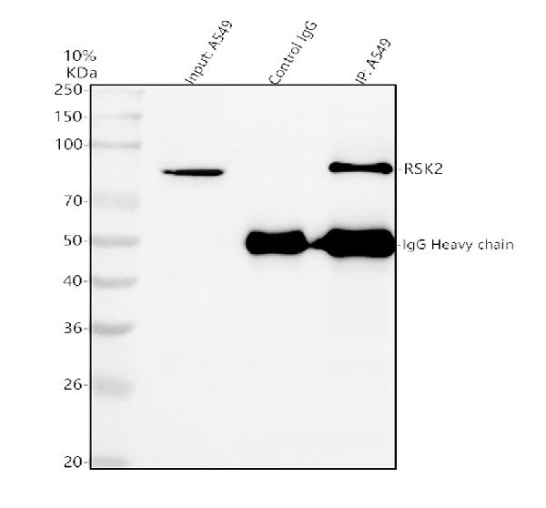 Figure 3. Immunoprecipitating RPS6KA3 in A549 whole cell lysate . Western blot analysis of RPS6KA3 using anti-RPS6KA3 antibody (A02215-2). Lane 1: A549 whole cell lysates (30ug) Lane 2: Rabbit control IgG instead of anti-RPS6KA3 antibody in A549 whole cell lysate. Lane 3: anti-RPS6KA3 antibody (2microg) + A549 whole cell lysate (500microg) After electrophoresis, proteins were transferred to a membrane. Then the membrane was incubated with rabbit anti-RPS6KA3 antigen affinity purified polyclonal antibody (A02215-2) at a dilution of 0.5 microg/mL and probed with a goat anti-rabbit IgG-HRP secondary antibody (Catalog # BA1054). The signal is developed using ECL Plus Western Blotting Substrate (Catalog # AR1197). A specific band was detected for RPS6KA3 at approximately 84 kDa. The expected band size for RPS6KA3 is at 84 kDa.