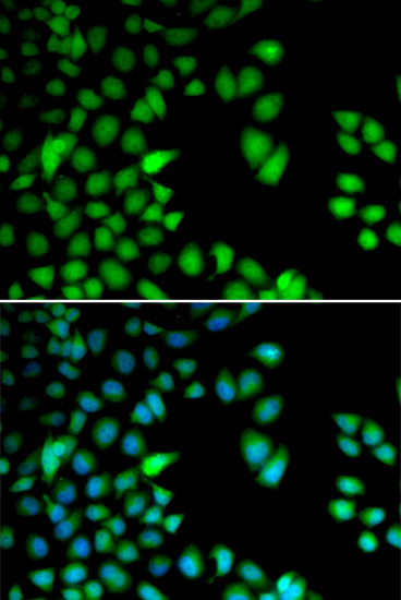 Immunohistochemistry of paraffin-embedded rat kidney using RPS6KA3 antibody  at dilution of 1:100 