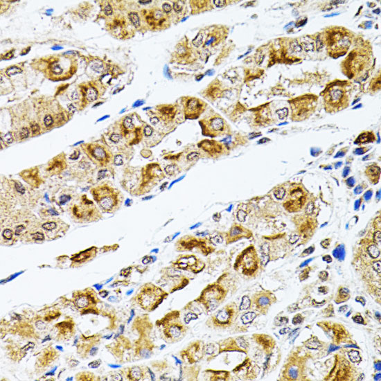 Immunohistochemistry of paraffin-embedded human stomach using RPS6KA3 antibody  at dilution of 1:100 
