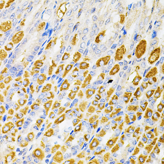a02215 rps6ka3 primary antiboties ihc testing 4