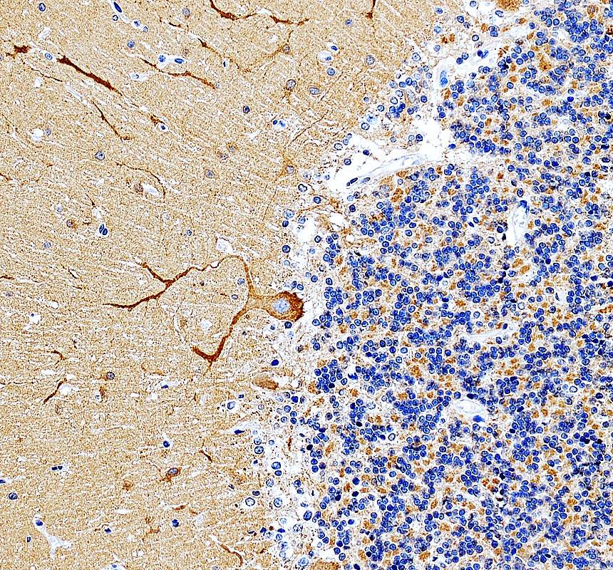 a02216 2 myo5a primary antibodies ihc testing 1