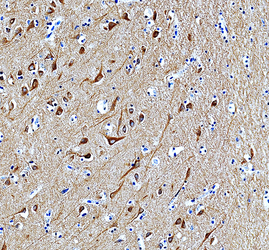 a02216 2 myo5a primary antibodies ihc testing 2