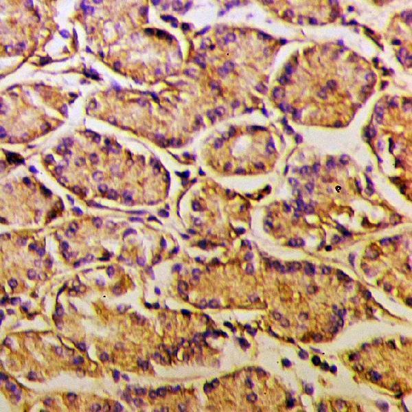 a02216 myo5a primary antiboties ihc testing 2