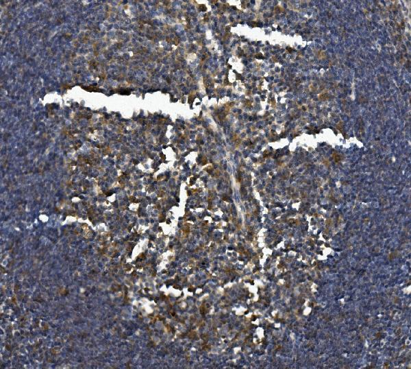 a02219 3 csf2rb primary antibodies ihc testing 2
