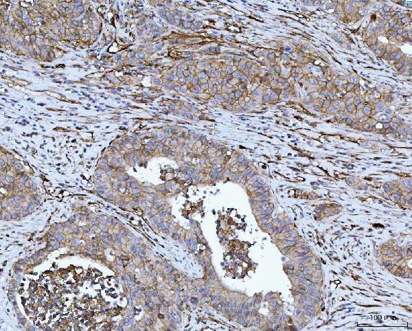 a02220 3 cd276 primary antibodies ihc testing 2
