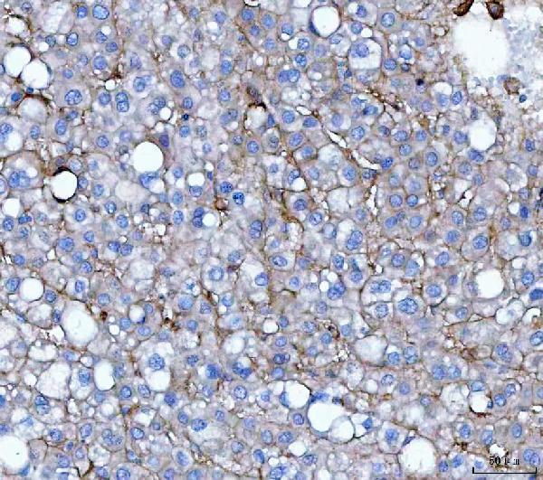 a02220 3 cd276 primary antibodies ihc testing 3