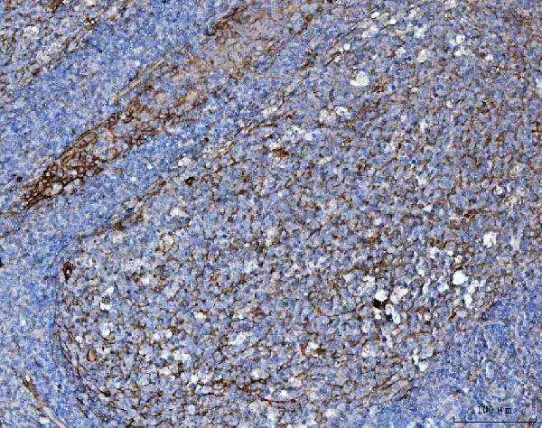 a02220 3 cd276 primary antibodies ihc testing 4