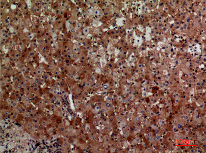 Immunohistochemical analysis of paraffin-embedded human-liver, antibody was diluted at 1:100