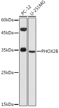 a02221 1 phox2b primary antiboties wb testing 1