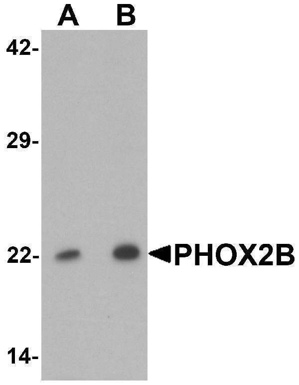 a02221 phox2b primary antibodies wb testing 1