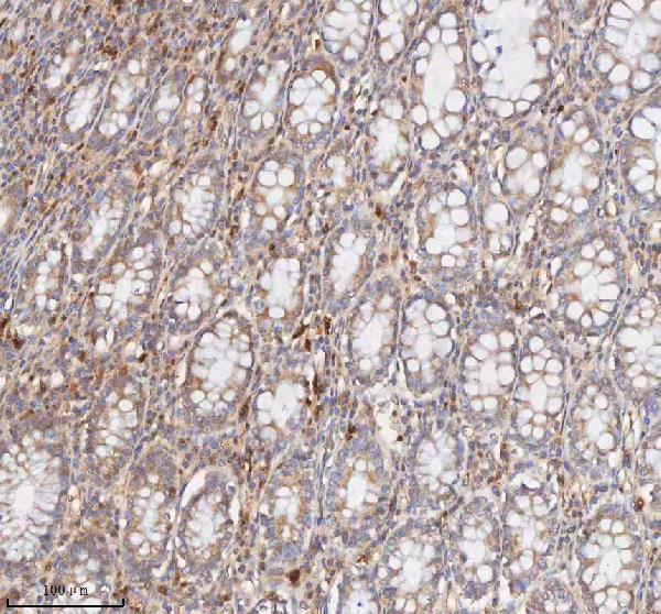  IHC analysis of CD127/IL7R using anti-CD127/IL7R antibody (A02222-3)